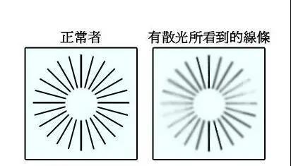 眼睛看不清，好視力眼貼教你判斷是否有這種狀況出現(xiàn)！