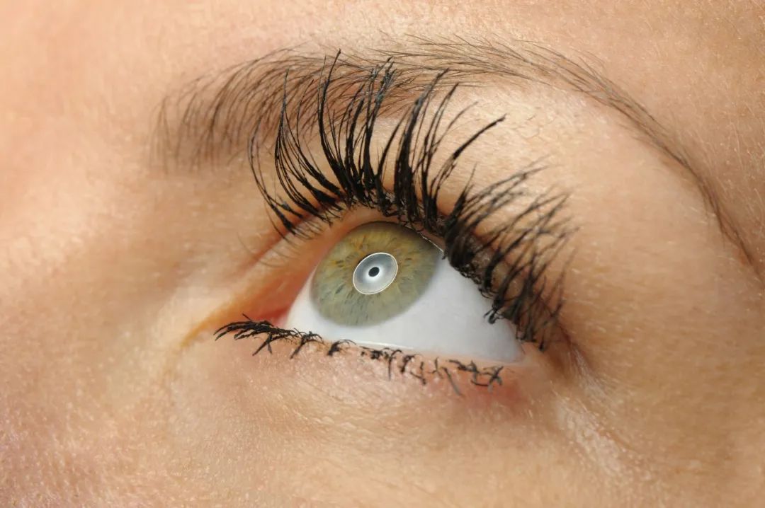 好視力眼貼分享：這五類人須更警惕干眼癥